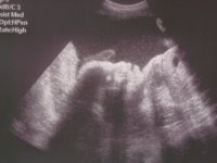 28 week ultra sound